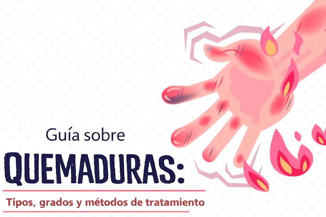 Qué hacer en caso de una quemadura | Guía práctica de primeros auxilios