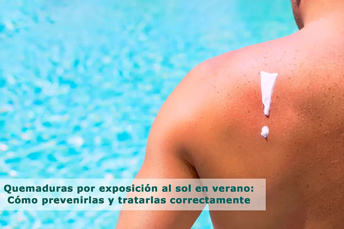 ¿Quemaduras solares o insolación? Los peligros del verano