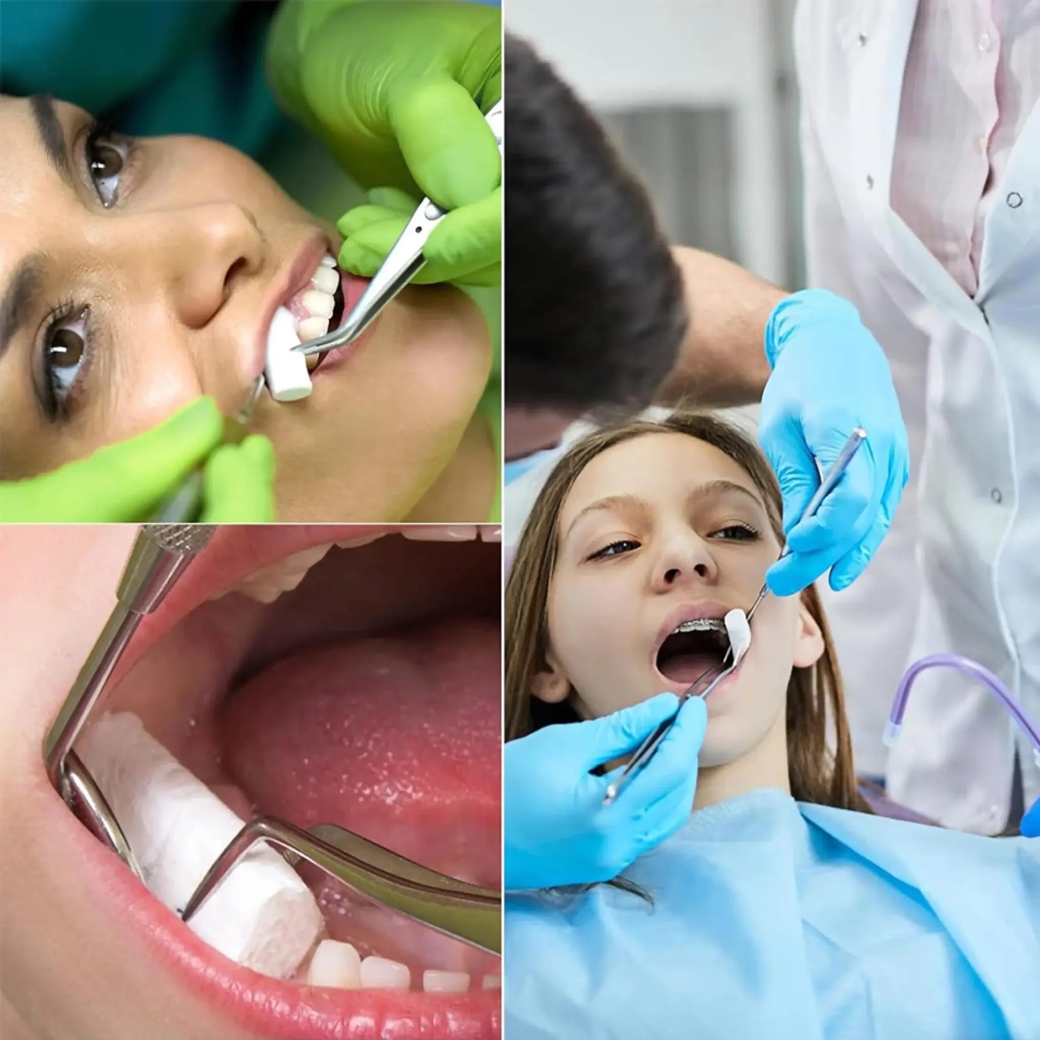 Algodón en Tórulas lisas 8mm. Insumos Dentales