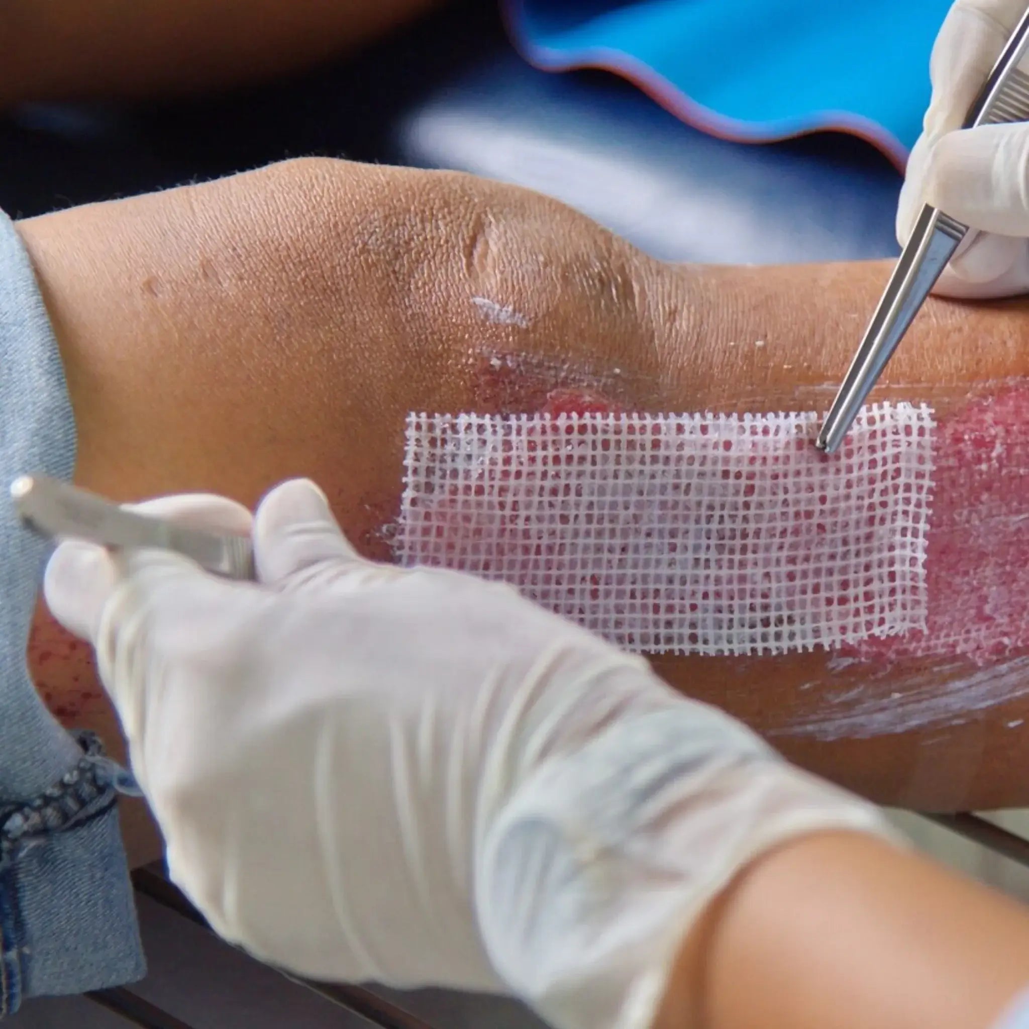 Gasa Parafinada 10x10cms. Insumos Médicos