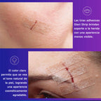 Steri Strip 6mm. x 7.5cm. R1541. Insumos Médicos