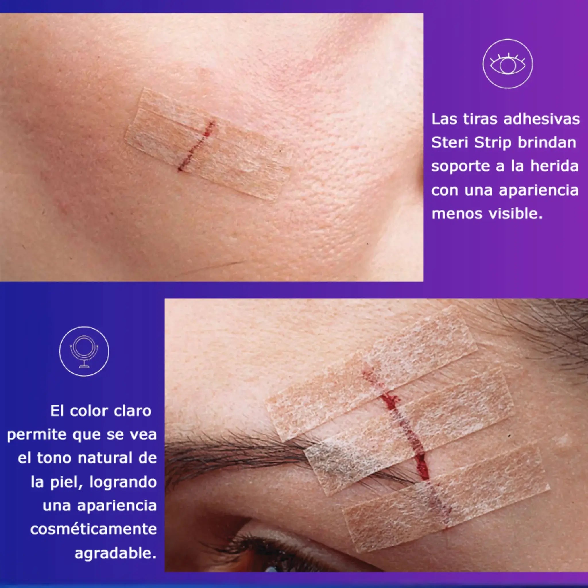 Steri Strip 6mm. x 7.5cm. R1541. Insumos Médicos