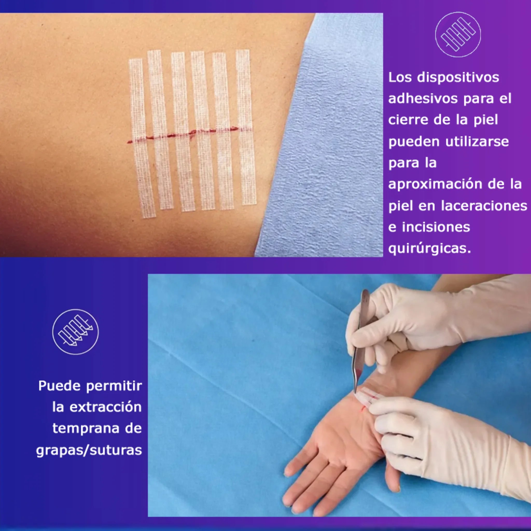 Steri Strip 6mm. x 7.5cm. R1541. Insumos Médicos