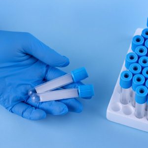 Insumos de Laboratorio